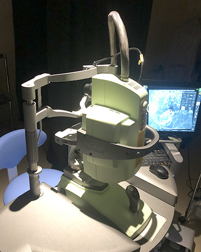 網黄斑浮腫に対するナビゲーションレーザー